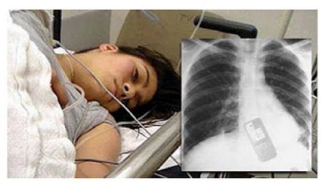 مراهقة تبتلع هاتفها حتى لا يكتشف صديقها أنها خائنة.. ماذا حلّ بها؟