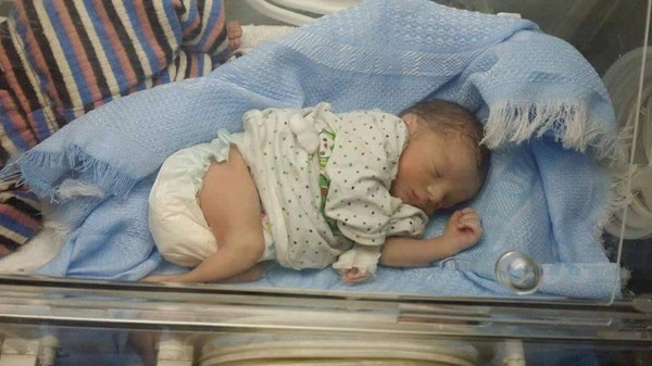 معجزة جديدة بحمص.. شظية تخترق بطن حامل ونجاة الجنين