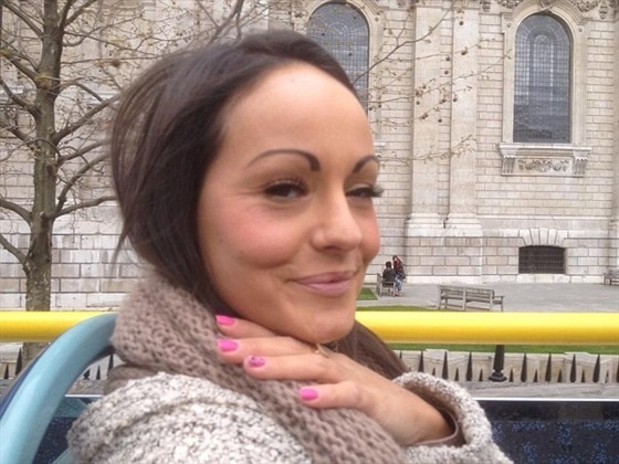 بالصور - امرأة تدعي إصابتها بالسرطان للحصول على المال.. إليكم القصة