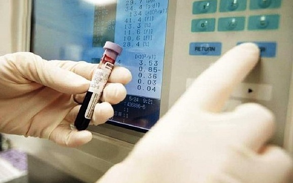 تحذير: نقص الحديد في الدم يزيد نسبة السكتات الدماغية