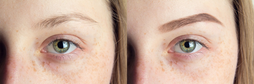 ما الرابط بين الحاجبين الرقيقين والغدة الدرقية؟