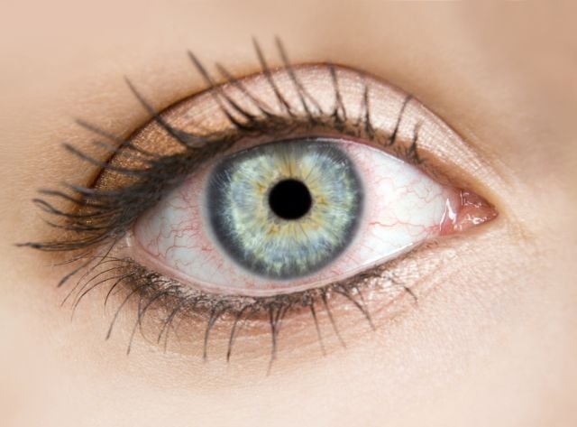هل يكون احمرار العينين دليلاً على نقص المناعة؟