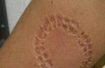 مواطنة لبنانية تتعرض للعض من قبل مرافق نائب برلماني