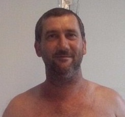 بالصور - عملية غريبة.. زرعوا يده في بطنه لهذا السبب!