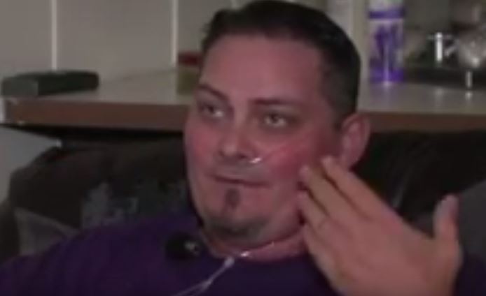 بالفيديو – خطأ طبي من طبيب أسنان غيّر حياته وشوهه!