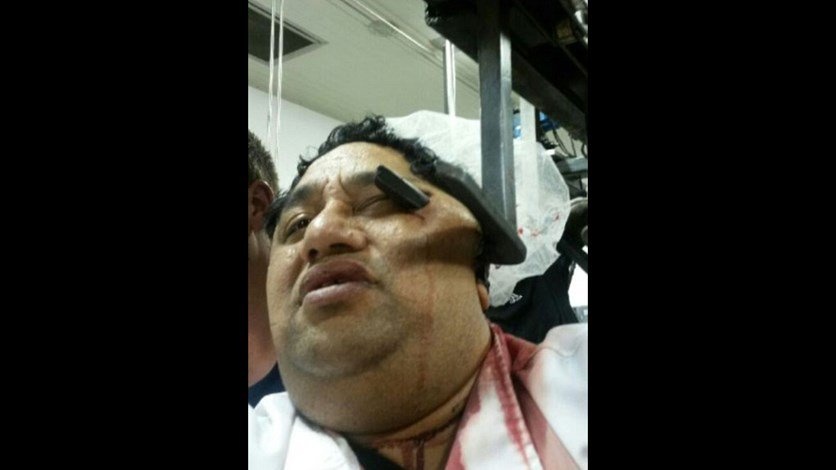 بالصور - ظلّ عالقاً بماكينة تقطيع اللحوم.. ماذا حدث له؟!