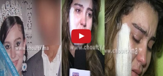 بالفيديو - زوج يشوه وجه زوجته بسبب خيانتها... وهي تفضحه!