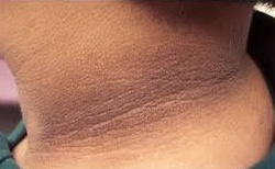 6 عوامل تسبب اسمرار رقبتك بشكل بشع... تجنبيها