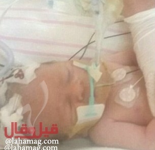 بالصور - ولادة طفلة بعد لحظات من وفاة والدتها
