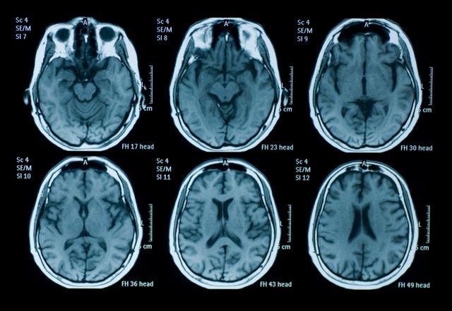 طبيب أعصاب يعلن: الصوم علاج لمختلف الأمراض المزمنة... اكتشفوا كيفية العلاج!!