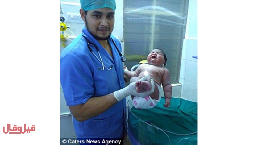 بالصوّر - ولادة أسمن طفلة في العالم بوزن 6.8 كيلو... شاهدوا شكلها
