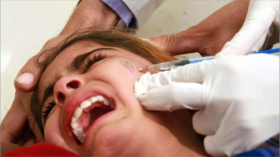 مرض خطر ينتشر من سوريا الى الشرق الأوسط.. احذروه!