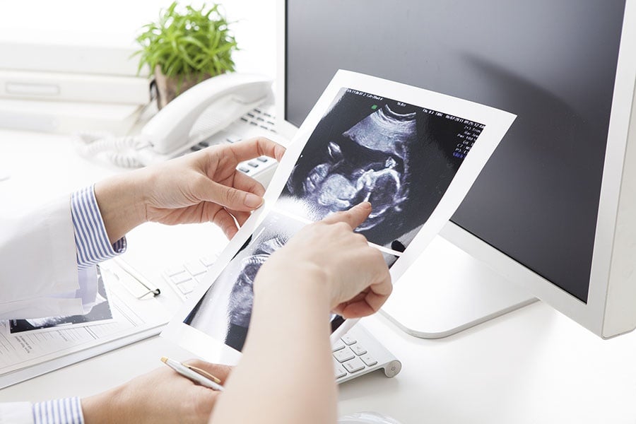 هذه هي الأسباب الحقيقية للإجهاض!