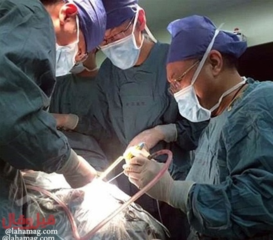 بالصور – والد يؤدب ابنته بمقص إخترق رأسها.. إليكم القصة!