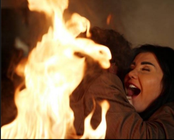 نجوم سوريّون يتعرضون للتشوّه بسبب التمثيل