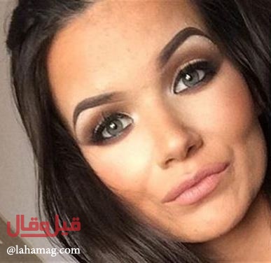 بالصور- أرادت تبييض أسنانها... فوقعت الكارثة!