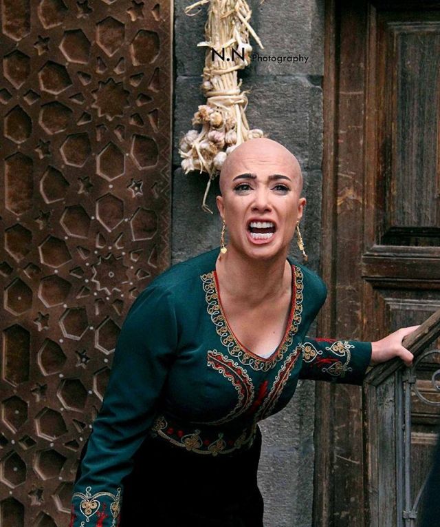 بالفيديو - أخيراً كشفت هذه الفنّانة عن صلعها في هذا الدور!