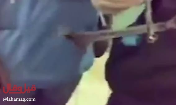 بالفيديو – شاهدوا لحظة إخراج مفتاح ربط من بلعوم رجل!