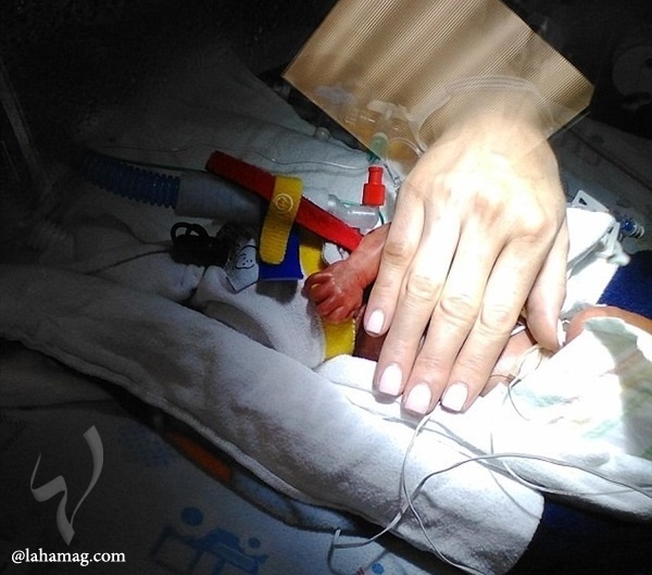 صور مؤثرة - هذا ما فعله الأطباء لإنقاذ رضيع.. إليكم القصة!