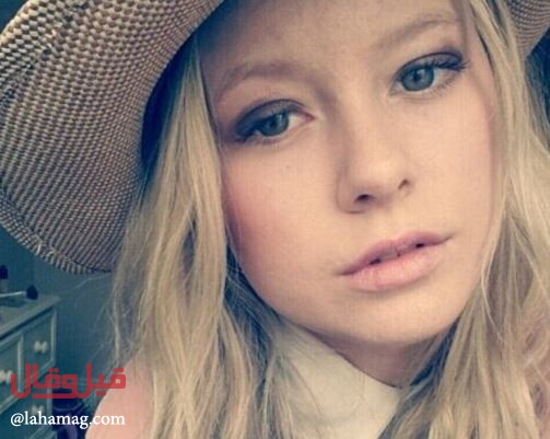 فقدت ابنتها بسرطان الجلد... فكيف حذّرت الأهالي؟!