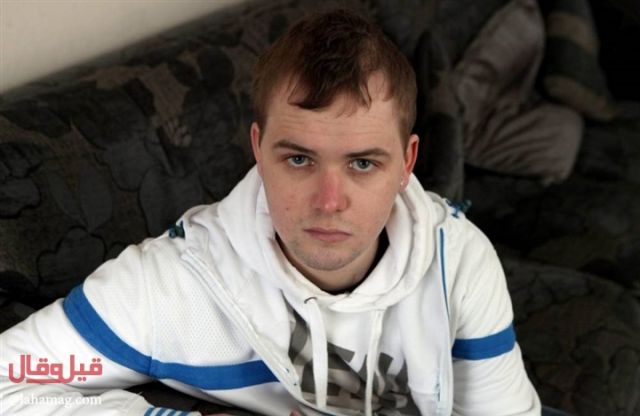 بالصور - خطأ طبي يحوّل رأس شاب الى 