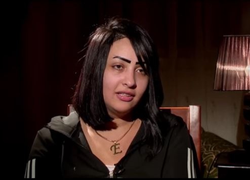 بالفيديو - نتائج كارثية في جسد فتاة بعد عملية شفط دهون.. شاهدوا ماذا حصل!؟