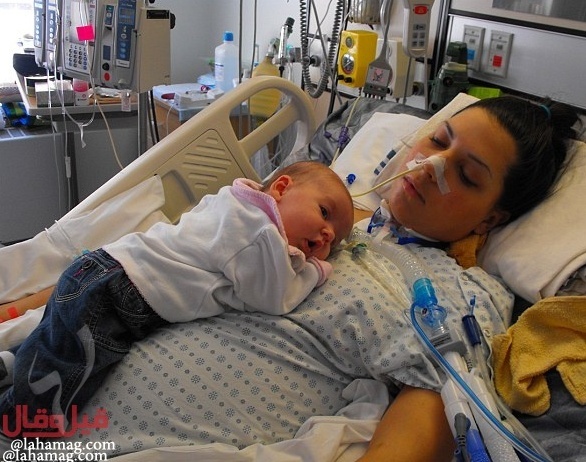 بالصور - انتصرت على مرض نادر للاعتناء بطفلتها.. إليكم القصة!