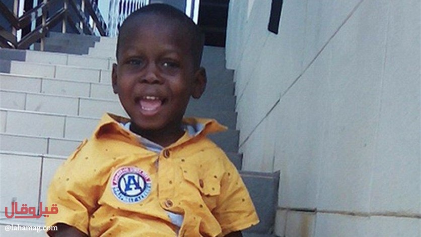 عملية جراحية ستغيّر مجرى حياة ابن الـ3 سنوات... إليكم التفاصيل!!