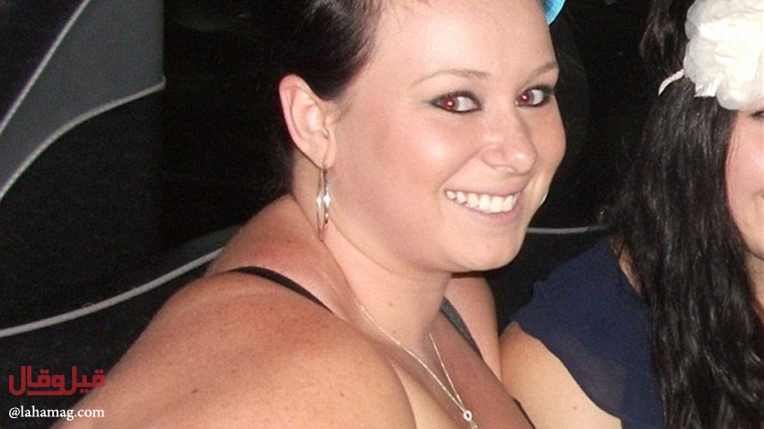 بالصور- خسرت حوالي نصف وزنها... لن تصدّقوا كيف أصبح جسمها!!