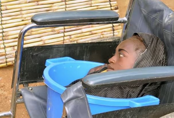 بالفيديو - حالة غريبة.. شابة تعيش في وعاء بلاستيكي!