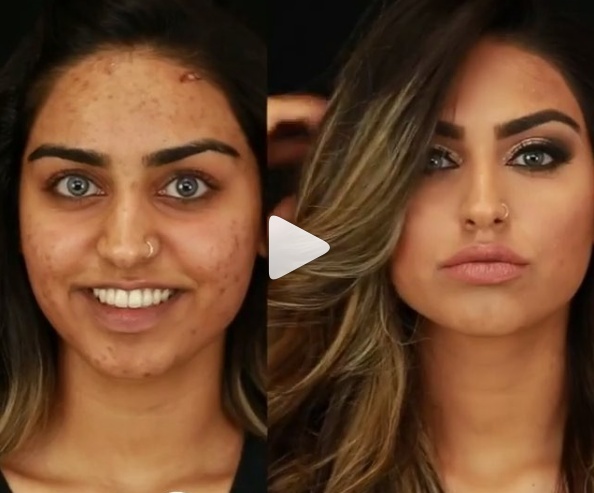 بالفيديو - تعلموا إخفاء بثور الوجه نهائياً بسهولة.. شاهدوا النتيجة بأنفسكم!