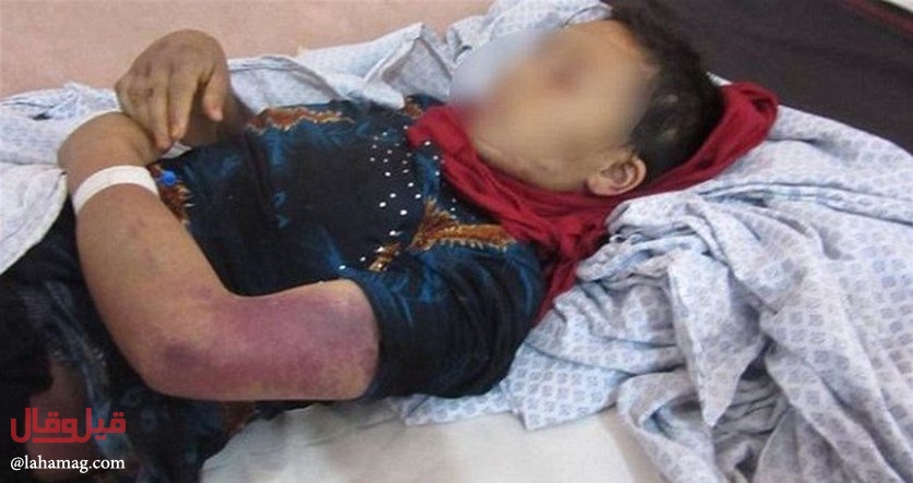 خسرت جنينها بعدما قام زوجها بقطع أجزاء من أعضائها بمساعدة والدته وشقيقته!!