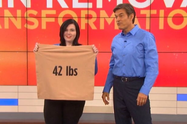 بالصور - خسرت 113 كيلو من وزنها وبقيت حرينة.. إليكم السبب!