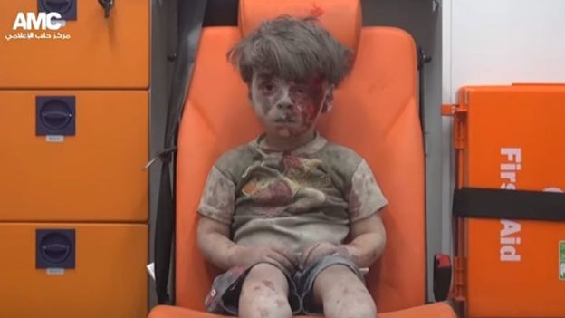 بالصور والفيديو - صورة الطفل السوري التي هزّت العالم.. هذه قصته