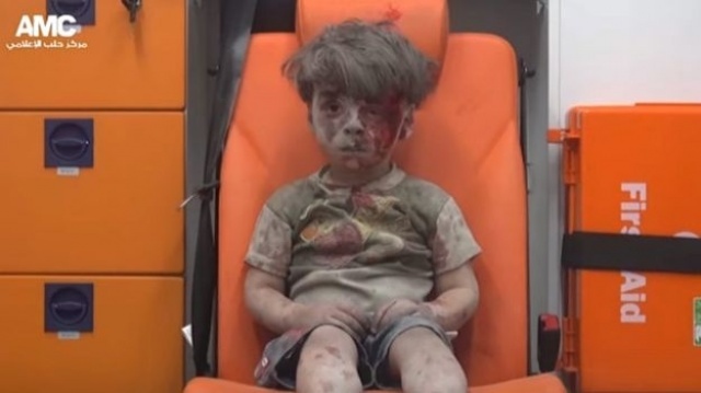 عاجل بالصور - فاجعة جديدة: وفاة شقيق الطفل السوري عمران الذي هزّ العالم