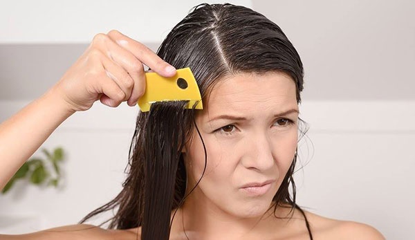 بعد انتشار بيع القمل للسيدات في دبي- القمل صديق شعرك أم عدوّه؟ إكتشفي الحقيقة