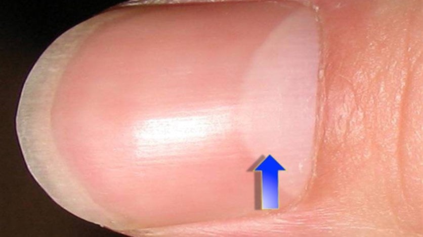 ماذا يعني وجود نصف قمر صغير على أظافركم.. وما تأثير ذلك على صحّتكم؟!