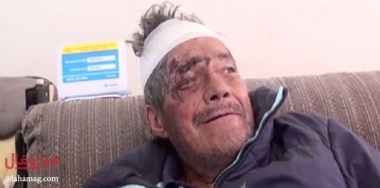 بعد شهرين من وفاته.. عائلة تُفاجأ بعودته الى الحياة!