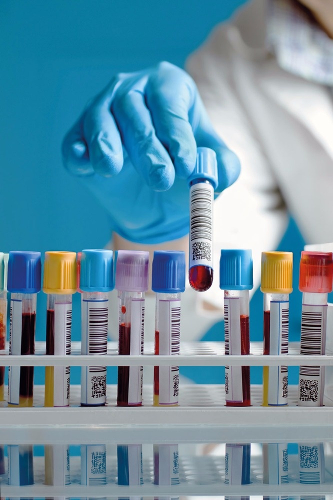 هذه هي المواعيد الصحيحة للفحوصات الطبية