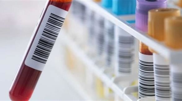 تحليل المخدرات الزامي في الفحص الطبي للراغبين بالزواج في هذا البلد العربي.. اليكم التفاصيل!!