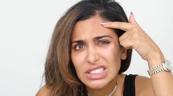 بالفيديو- كيف تتخلّصون من حب الشباب بطريقة طبيعية ومن دون أي تكاليف؟؟ اليكم الوصفة السحرية