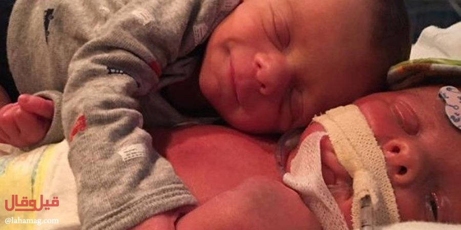 بالصورة- قصة رضيع احتضن توأمه المتوفي وأبكى الملايين