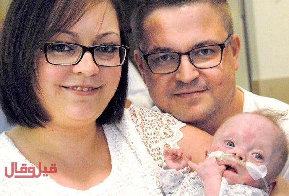 بالصور- وزن اصغر رضيعة في العالم لم يتجاوز وزن حبة الفلفل.. فكيف بقيت على قيد الحياة.. اليكم قصّتها