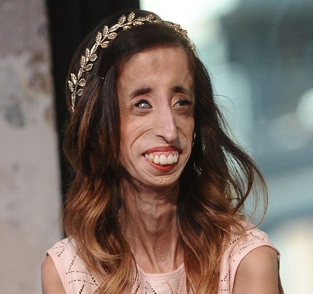 بعد وصفها بـ