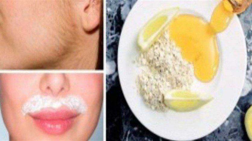 وصفة منزلية سهلة للتخلّص من الشعر الزائد في الوجه نهائياً.. جرّبيها ولاحظي الفرق!