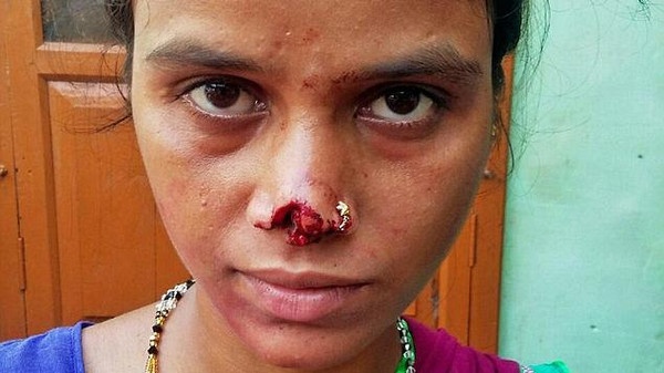 لأغرب سبب.. قطع أنف زوجته وهرب به!