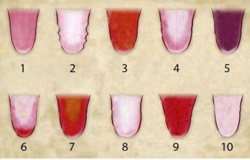 إعرف مرضك من لون وشكل لسانك