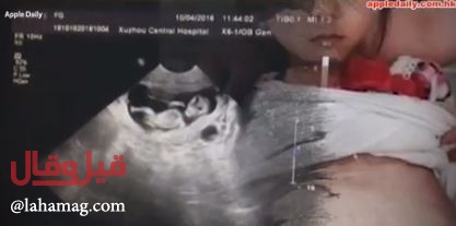 بالفيديو - طفلة حامل من رجل يكبرها بـ 28 عاماً.. إليكم القصة!