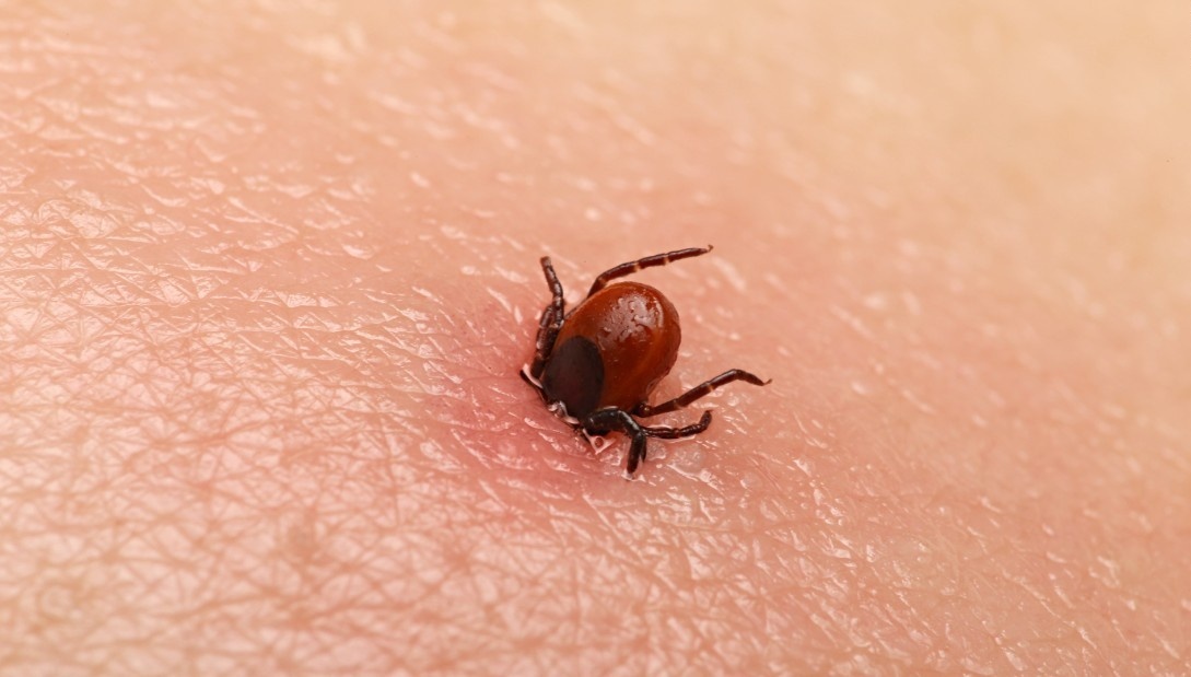 هذا المزارع توفي فجأة بعد لدغة عث!! وما اكتشفه الأطباء بعد ذلك رهيباً