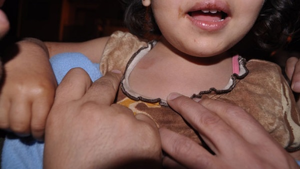 طفلة بحرينية تروي ببراءة تفاصيل الاعتداء عليها جنسياً من قبل شاب!